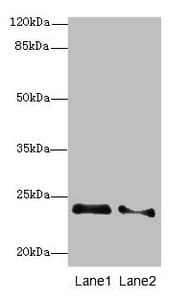 Polyclonal Rabbit anti-Human TC21 / RRAS2 Antibody (IHC, WB)