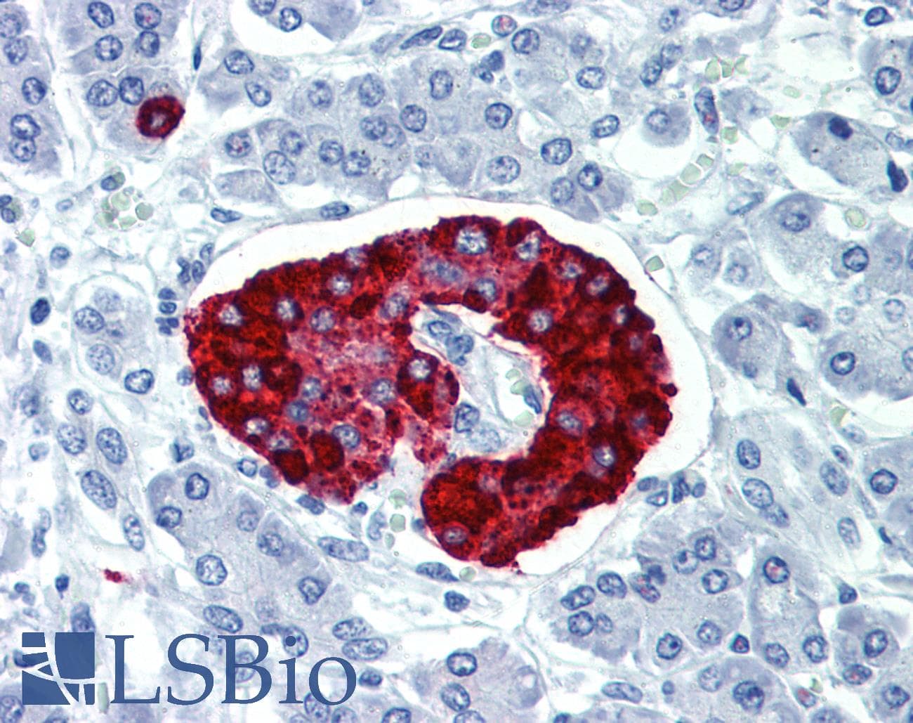 IHC-plus™ CPE / Carboxypeptidase E Antibody (C-Terminus)