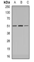 Polyclonal Rabbit anti-Human IRAK4 / IRAK-4 Antibody (WB)