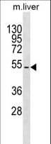 TBX15 Antibody (aa47-73)