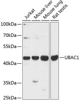 Polyclonal Rabbit anti-Human UBAC1 / KPC2 Antibody (WB)