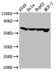 FZD10 / Frizzled 10 Antibody