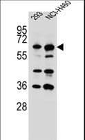 IHC-plus™ CKAP4 Antibody (aa574-602)