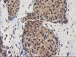 GRHPR / Glyoxylate Reductase Antibody (clone OTI2H4)