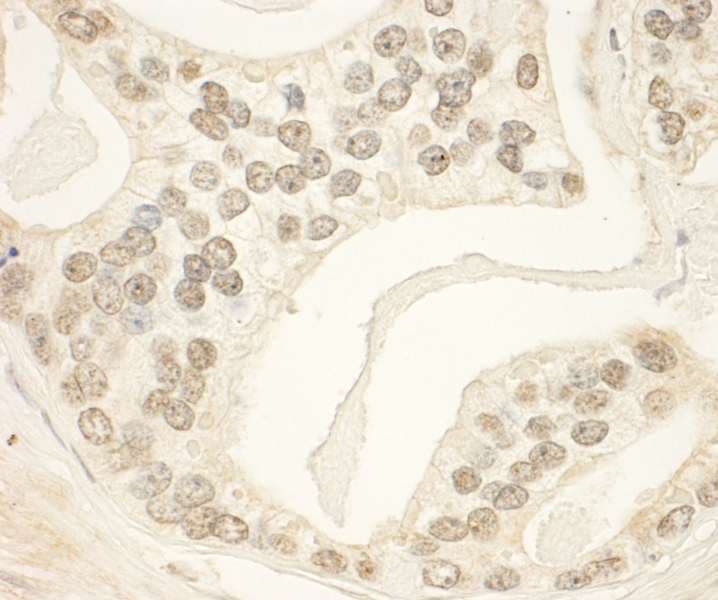 PHF23 Antibody (aa353-403)