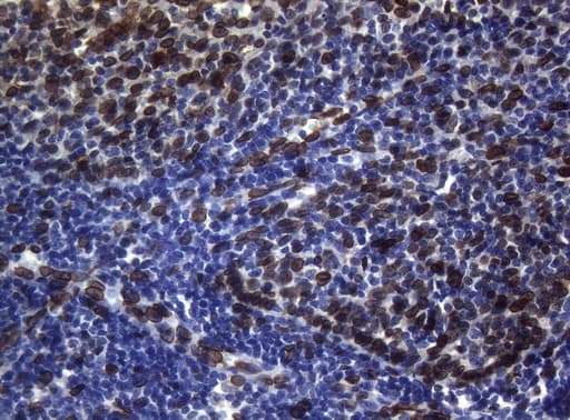 BCL6 Antibody (aa1-300, clone OTI1C3, Carrier-free)