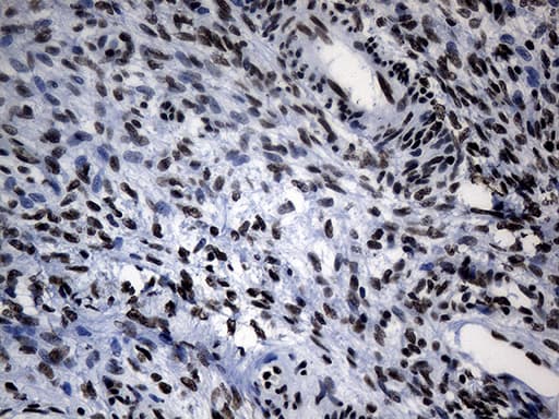 Monoclonal Mouse anti-Human POLR2A / RNA polymerase II Antibody (clone OTI3C8, aa1351-1614, IHC, WB)