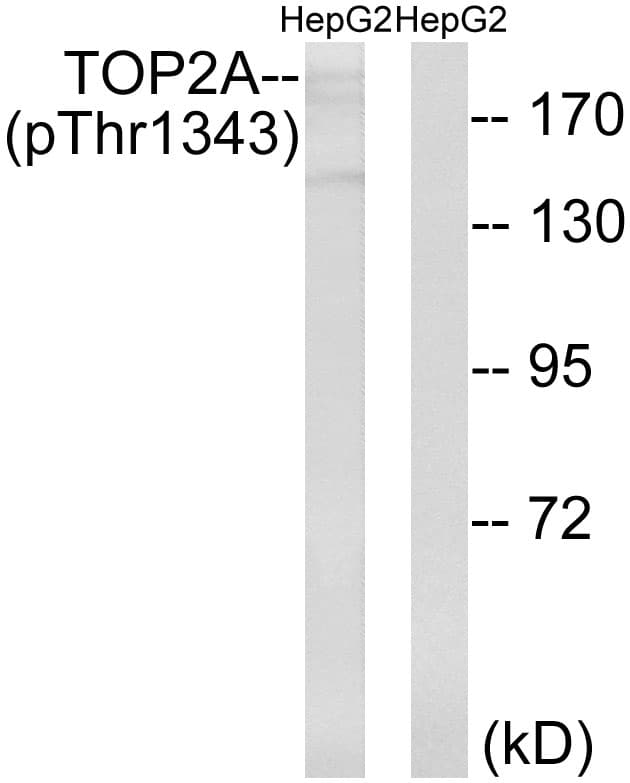 Polyclonal Rabbit anti-Human TOP2A / Topoisomerase II Alpha Antibody (phospho-Thr1343, WB)