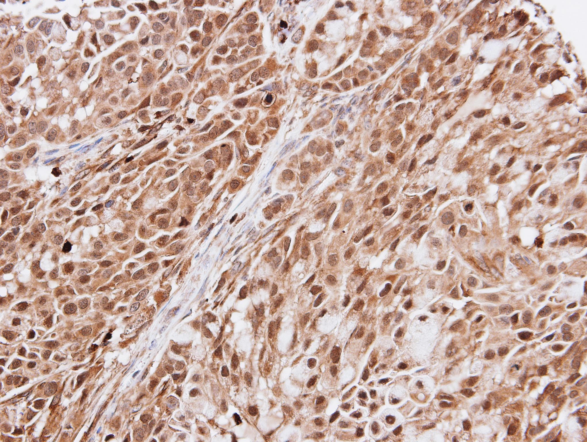 Polyclonal Rabbit anti-Human EFCAB14 Antibody (aa243-495, IHC, WB)