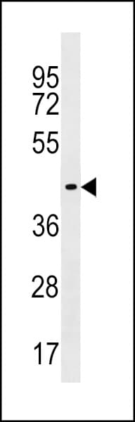ZNF662 Antibody (aa391-417)