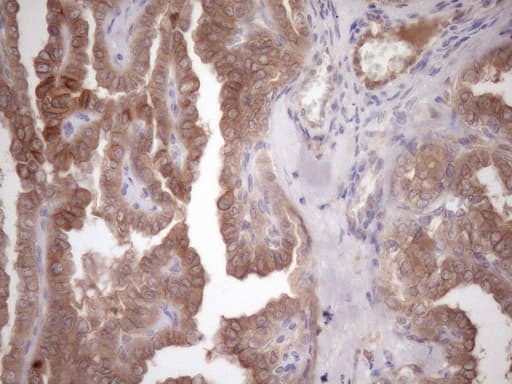 c-Met Antibody (aa570-885, clone UMAB190)