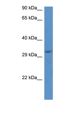 JMJD8 Antibody (aa170-219)