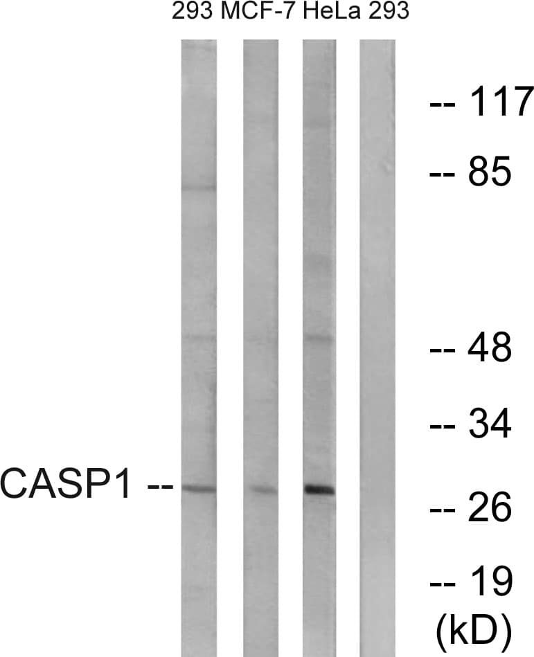 CASP1 / Caspase 1 Antibody (aa342-391)