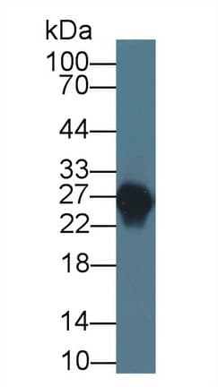 APOA1 / Apolipoprotein A 1 Antibody (aa25-265)