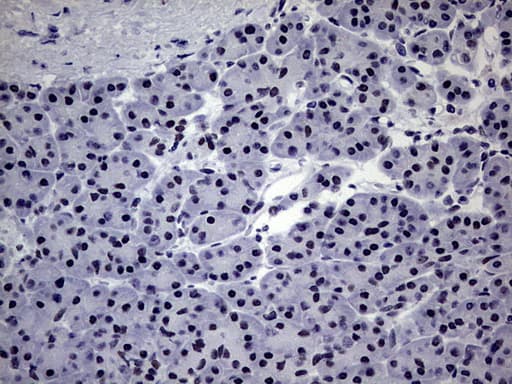 ZNF34 Antibody (aa117-405, clone OTI3G2, Carrier-free)