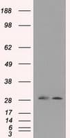 RPA2 / RFA2 / RPA34 Antibody (clone OTI3A12, Carrier-free)