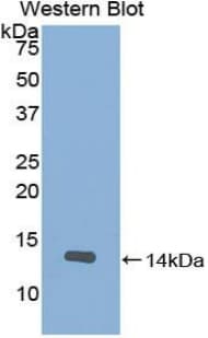 SLIT2 Antibody (aa1408-1519, Biotin)