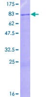 Human ZNF57 Protein (Recombinant GST)