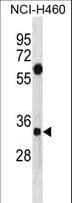 SDCBP / Syntenin Antibody (aa1-30)