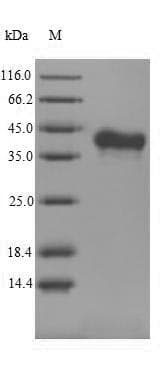 Mouse TNFSF11 / RANKL / TRANCE Protein (Recombinant 6His-SUMO, N-terminus)