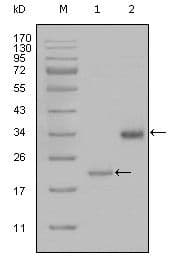 LPA / Lipoprotein a Antibody (clone 8F6A9,8H5C5)
