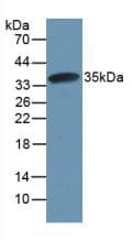 Rat CAPN1 / Calpain 1 Protein (Recombinant His, N-Terminal)