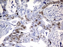 Monoclonal Mouse anti-Human MKI67 / Ki67 Antibody (clone OTI5D7, IHC)