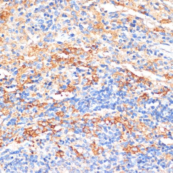 APCS / Serum Amyloid P / SAP Antibody
