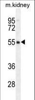 Polyclonal Rabbit anti-Human FBXO47 Antibody (aa114-143, IHC, WB)