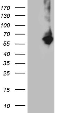RNF149 Antibody (aa250-383, clone OTI6D9, Carrier-free)
