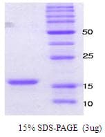 Human SNCA / Alpha-Synuclein Protein (Recombinant)