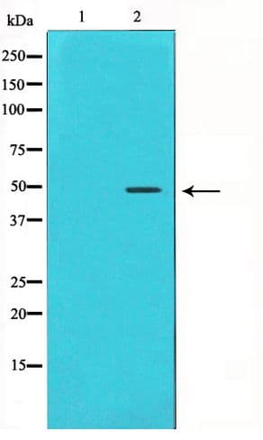 Polyclonal Rabbit anti-Human CCNE1 / Cyclin E1 Antibody (IHC, IF, WB)