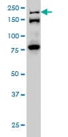 IHC-plus™ Monoclonal Mouse anti-Human ESPL1 / Separase Antibody (clone 6H6, IHC, WB)