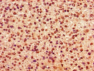 Polyclonal Rabbit anti-Human HIST1H2AI Antibody (IHC, IF, WB)