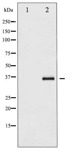 NFKBIE / IKB Epsilon Antibody (phospho-Ser22)
