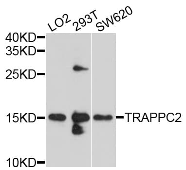 Polyclonal Rabbit anti-Human TRAPPC2 / SEDL Antibody (WB)