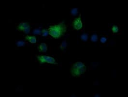 CD1C Antibody (clone OTI1H9)