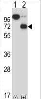 Polyclonal Rabbit anti-Human ARIH2 Antibody (aa445-474, IHC, WB)