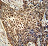 Polyclonal Rabbit anti-Human METTL4 Antibody (aa315-344, IHC, WB)