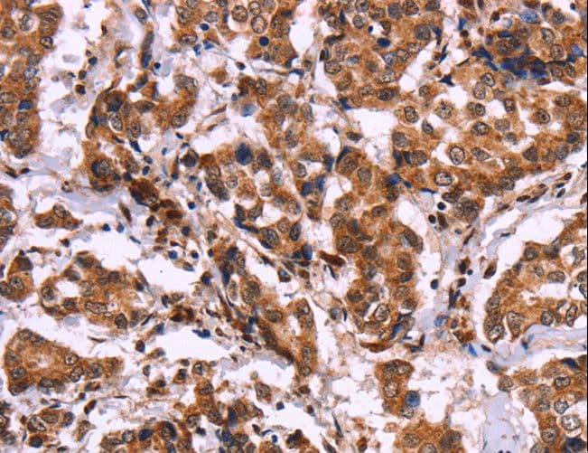 CARMA1 / CARD11 Antibody