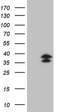 POU2AF1 / BOB1 Antibody (clone OTI3B9)
