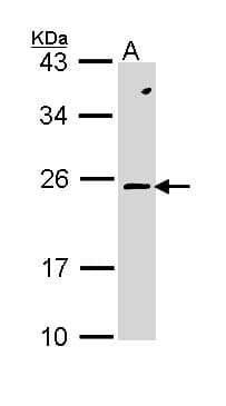 Polyclonal Rabbit anti-Human RAC2 Antibody (WB)