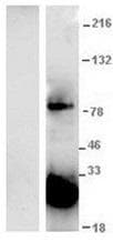 GFP Antibody (clone IQGFP5 Polyclonal)