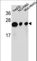 Polyclonal Rabbit anti-Human ATP5H Antibody (aa68-97, IHC, WB)