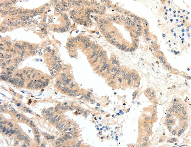 RRAD Antibody