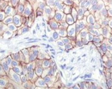 IGF1R / IGF1 Receptor Antibody (clone 3C8B1)