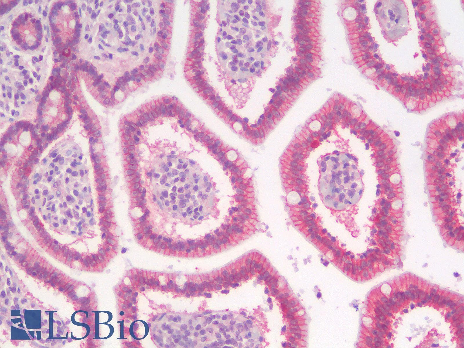 PathPlus™ CTNNB1 / Beta Catenin Antibody