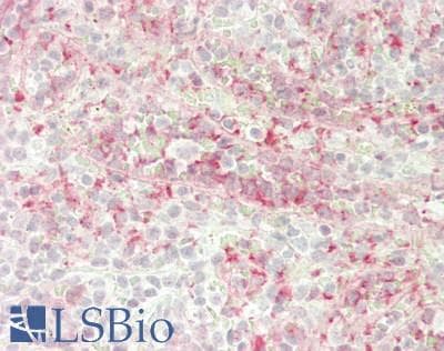 IHC-plus™ MDK / Midkine Antibody