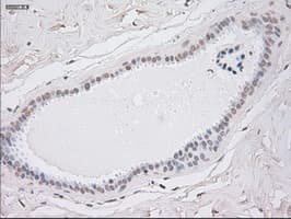 KRT8 / CK8 / Cytokeratin 8 Antibody (clone OTI1B12)