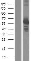 PFK2 / PFKFB3 Protein (Over-Expression Lysate Myc-DDK (Flag))